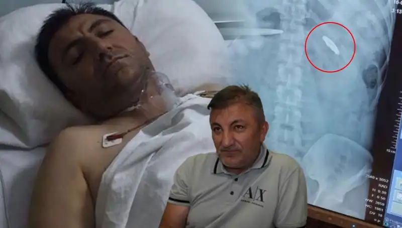 15 Temmuz’un Gölgesinde: Vücudunda Kurşunla 9 Yıl Yaşayan Kahraman