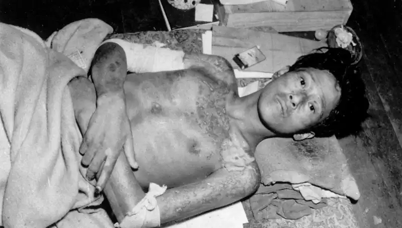 80 Yıl Sonra Nagasaki'den Gelen Uyarı: Nükleer Tehdit Kapıda